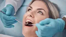 Wisdom Tooth