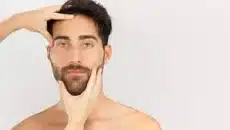 Beard Transplant