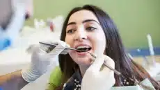 Dental Crowns