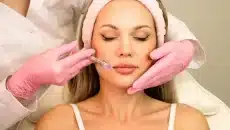 Lip Fillers