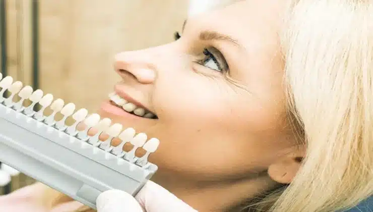 Smile Design